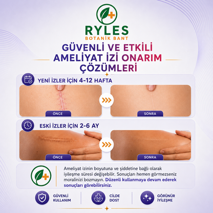 Ryles Ameliyat İz Bandı — Premium Silikon Rulo Bant | Tıbbi Sınıf