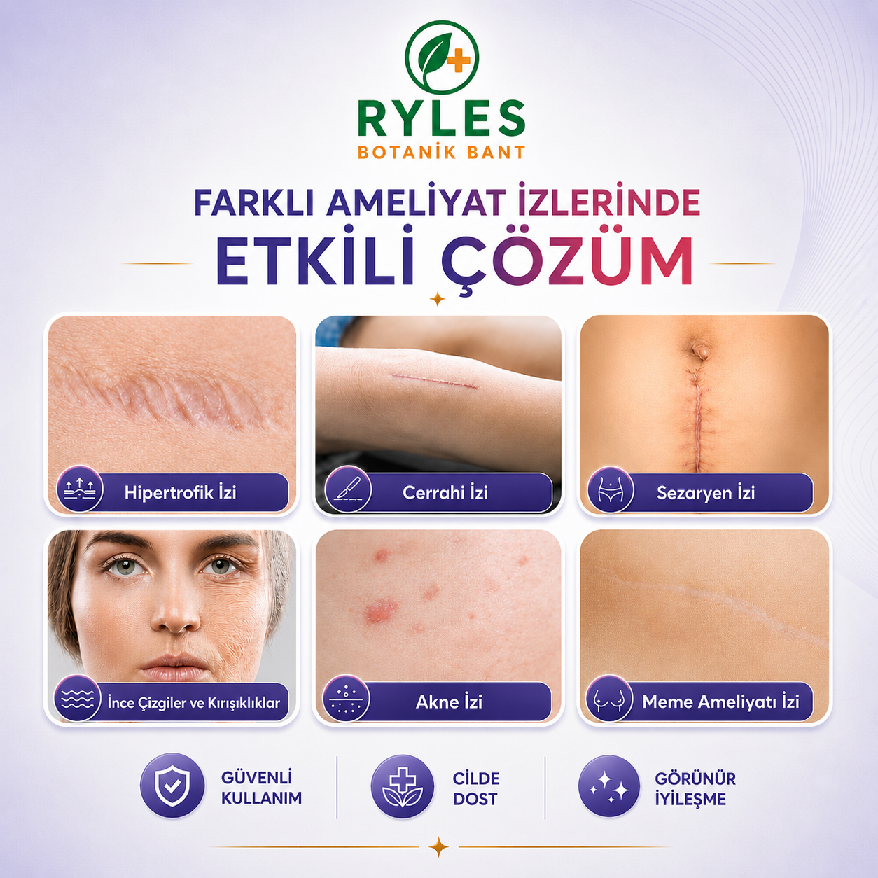 Ryles Ameliyat İz Bandı — Premium Silikon Rulo Bant | Tıbbi Sınıf