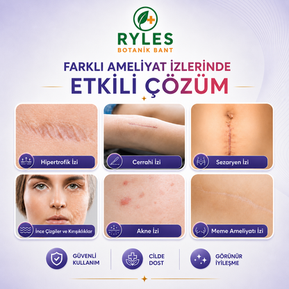 Ryles Ameliyat İz Bandı — Premium Silikon Rulo Bant | Tıbbi Sınıf