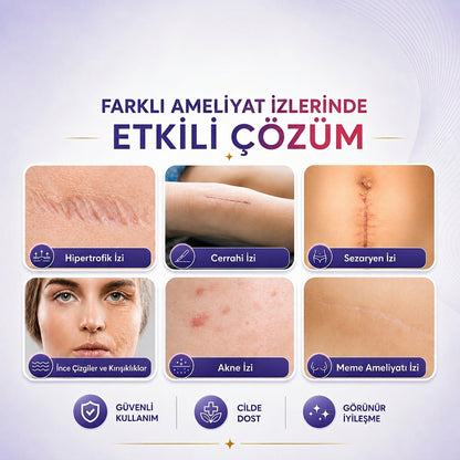 Lumea Silikon İz Bandı — Premium Silikon Rulo Bant | Tıbbi Sınıf